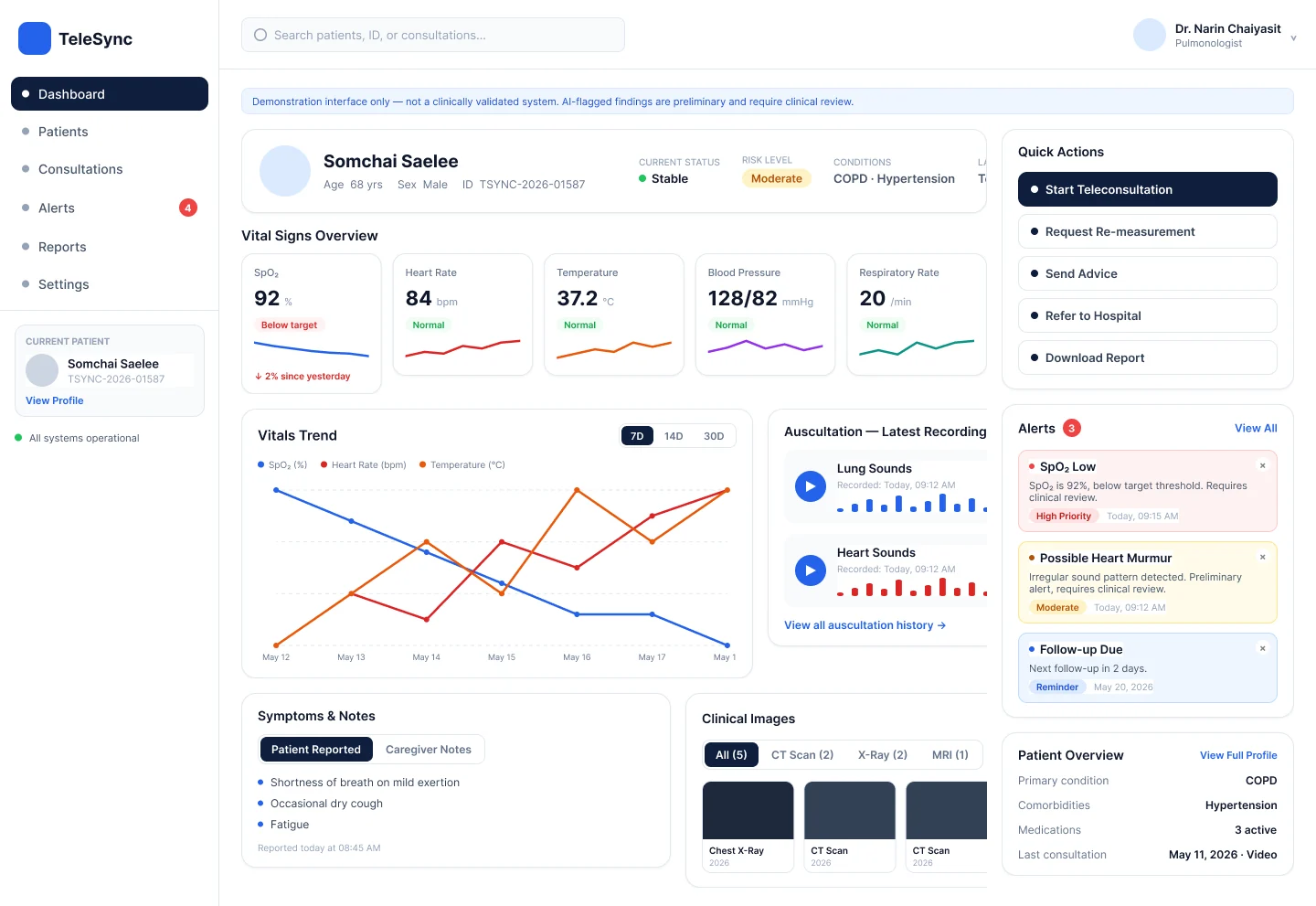 The TeleSync doctor dashboard showing a patient’s vital signs and trends
